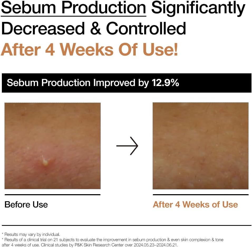 ANUA Rice 70 Glow Milky Toner, for Glass Skin, Korean Skin Care, 250ml/8.45fl.oz.