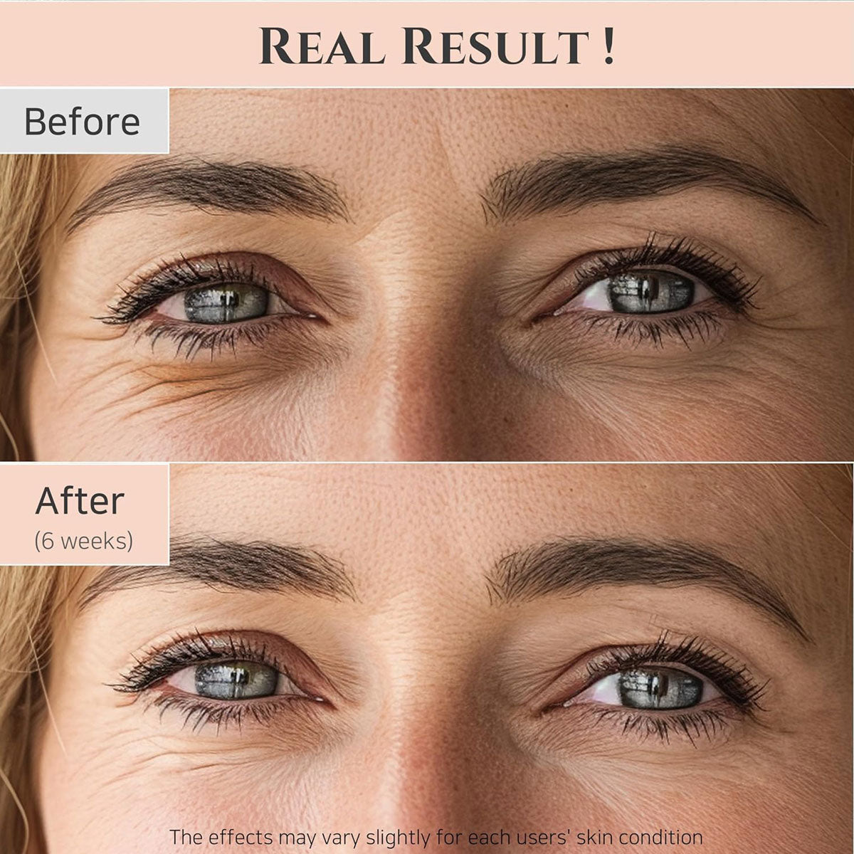 Beauty of Joseon Korean Eye Serum: Ginseng + Retinal 30ml, Pink, 1 Fl Oz (Pack 1)