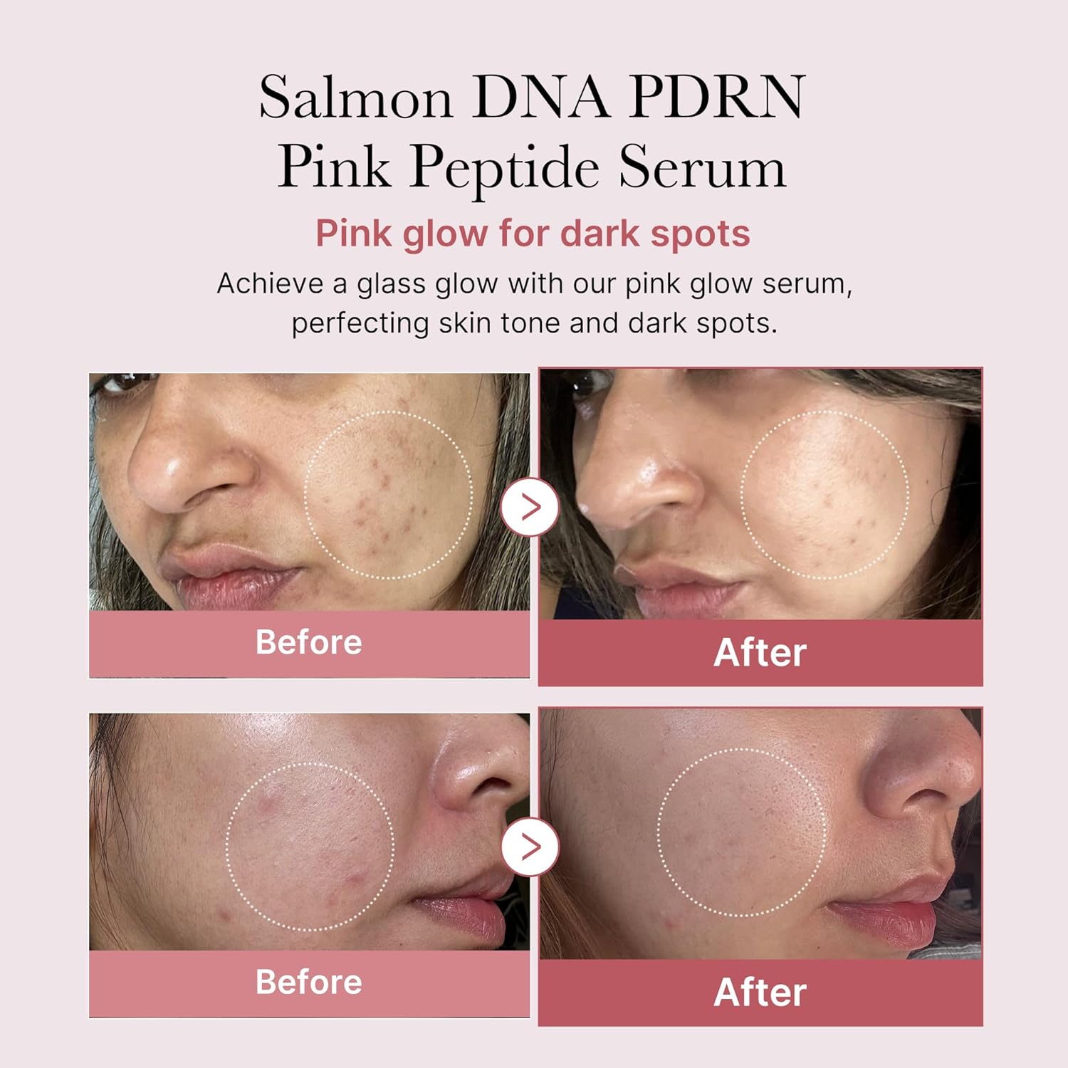Medicube Salmon DNA PDRN Pink Peptide Serum, 1.01 fl.oz.