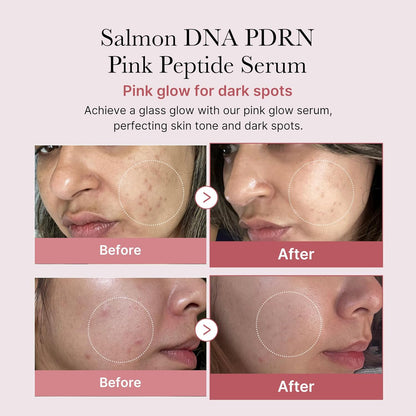 Medicube Salmon DNA PDRN Pink Peptide Serum, 1.01 fl.oz.